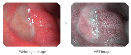 Video Endoscope System V2